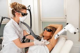 gezichtsontharing laser